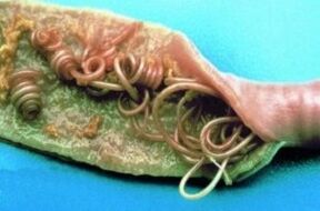 Apvaliosios kirmėlės